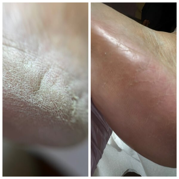 Καλλωπιστικό pedicure online