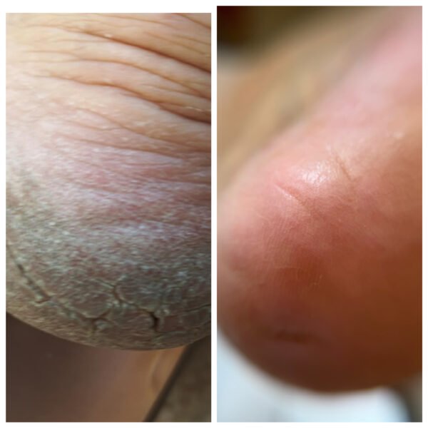 Καλλωπιστικό pedicure online