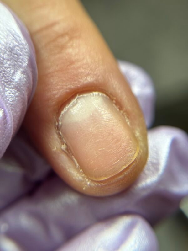 IMG_2581 Combi Manicure & μικροδιορθώσεις στο ελεύθερο άκρο