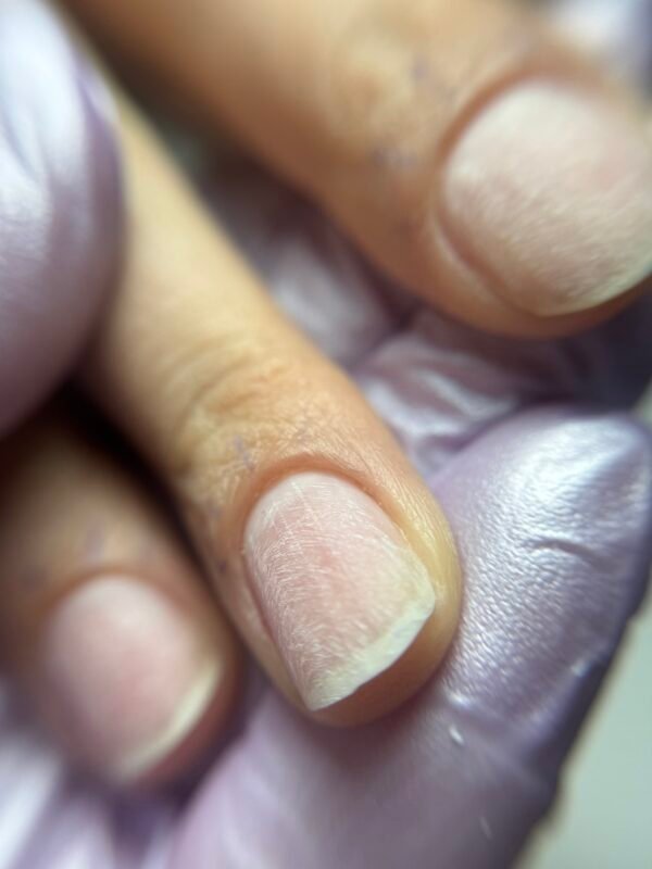 IMG_8864 Combi Manicure & μικροδιορθώσεις στο ελεύθερο άκρο