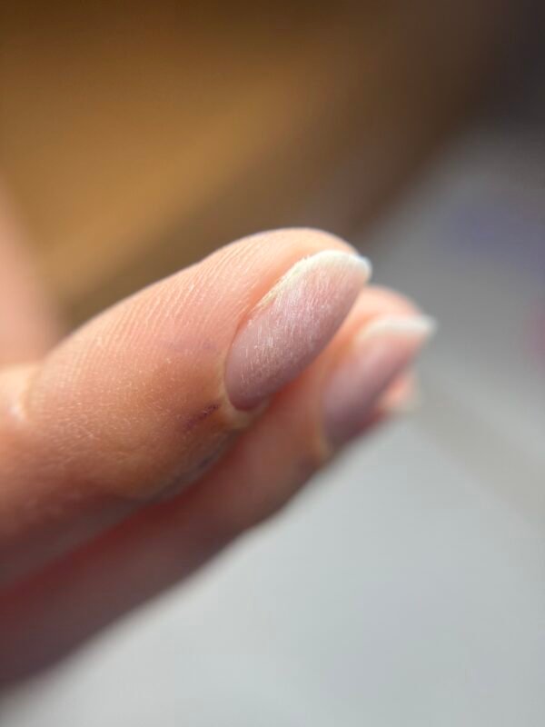 IMG_8867 Combi Manicure & μικροδιορθώσεις στο ελεύθερο άκρο