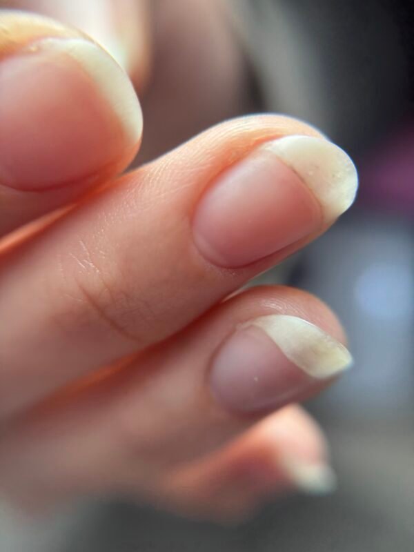 IMG_8908 Combi Manicure & μικροδιορθώσεις στο ελεύθερο άκρο