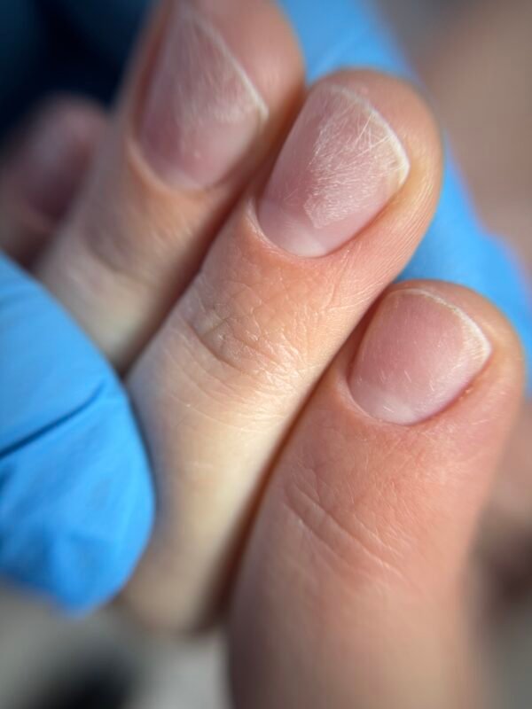 IMG_9253 Combi Manicure & μικροδιορθώσεις στο ελεύθερο άκρο