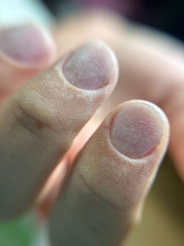 IMG_9352 Combi Manicure & μικροδιορθώσεις στο ελεύθερο άκρο