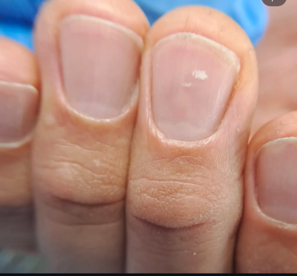 polish_save Combi Manicure & μικροδιορθώσεις στο ελεύθερο άκρο