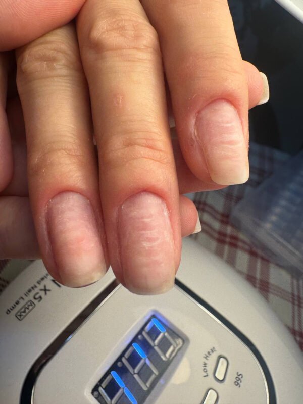 E book ‘Τραύματα νυχιών που διώχνουν την πελάτισσα: πώς προκαλούνται & αντιμετώπιση’