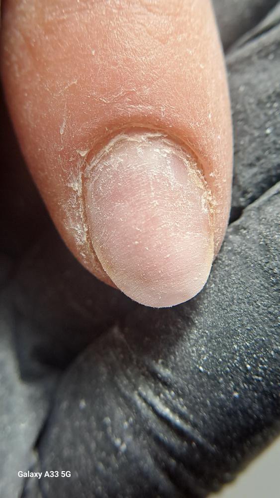 E book ‘Τραύματα νυχιών που διώχνουν την πελάτισσα: πώς προκαλούνται & αντιμετώπιση’