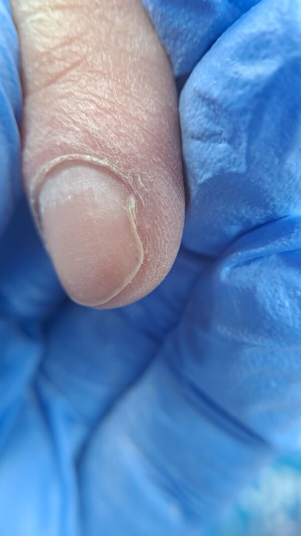 E book ‘Τραύματα νυχιών που διώχνουν την πελάτισσα: πώς προκαλούνται & αντιμετώπιση’