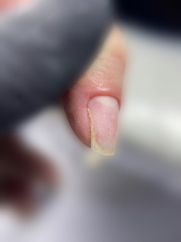 E book ‘Τραύματα νυχιών που διώχνουν την πελάτισσα: πώς προκαλούνται & αντιμετώπιση’