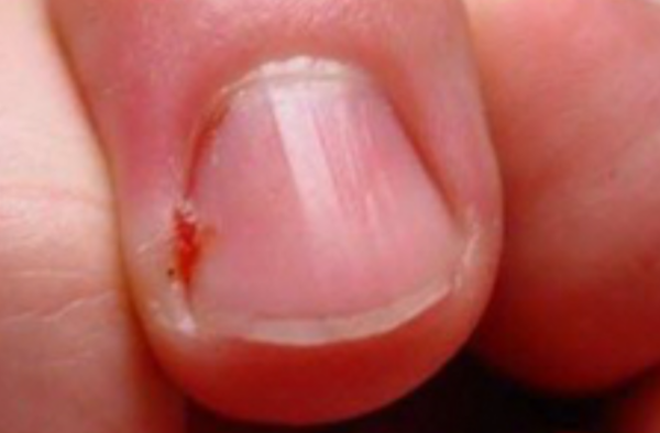 E book ‘Τραύματα νυχιών που διώχνουν την πελάτισσα: πώς προκαλούνται & αντιμετώπιση’